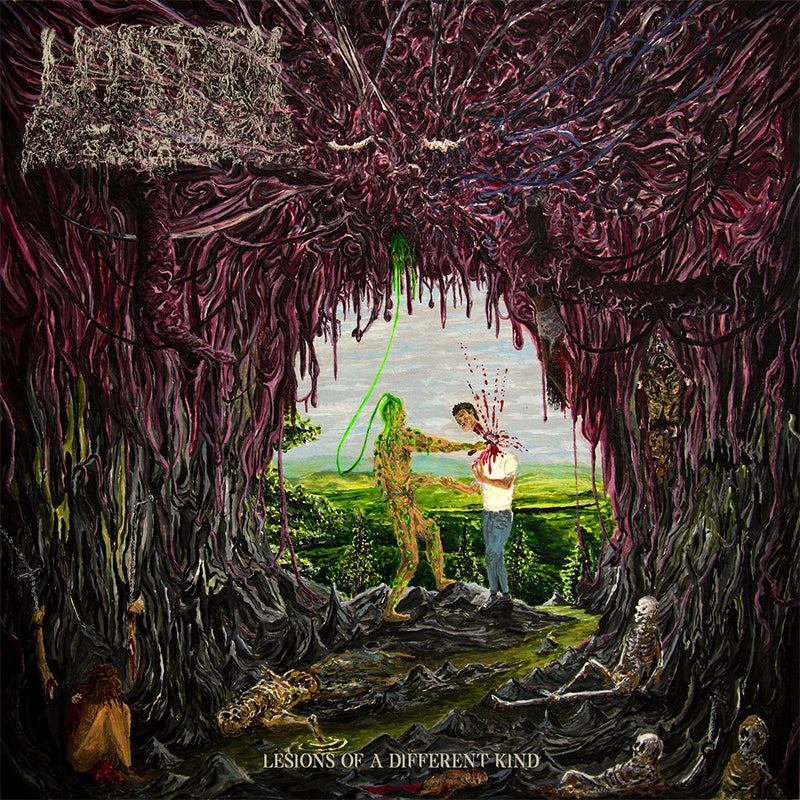 UNDEATH - Lesions of a Different Kind - LP - Slime Green Vinyl